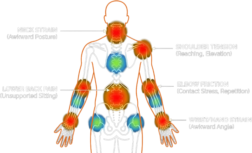 Heatmap diagram showing common tension zones from poor ergonomics, including neck strain, lower back pain, and wrist tension.